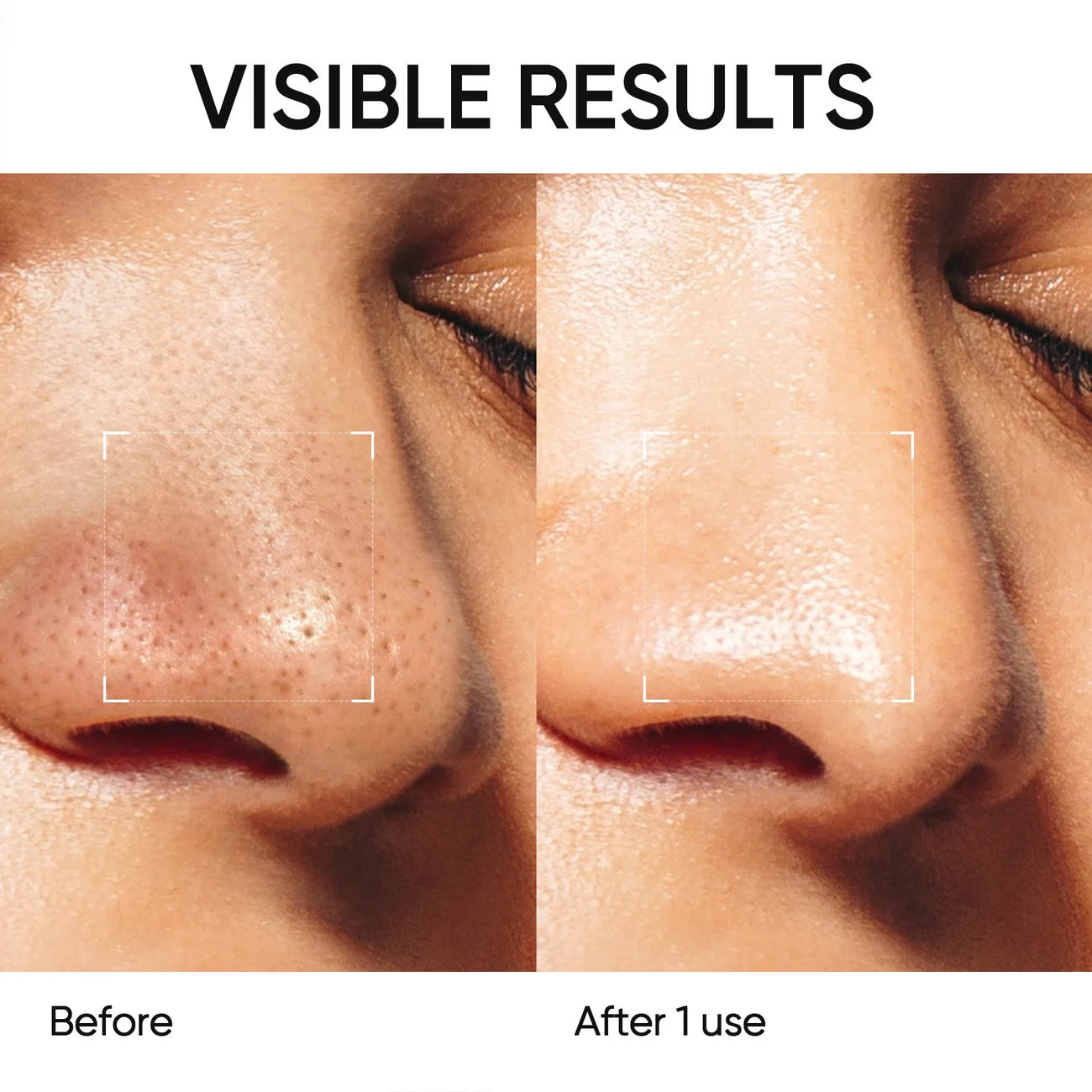 Pohaku™ Clear Skin Duo Set